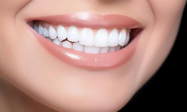 Tam Seramik Diş Kaplamaları - Dt. Hejan Kılıç